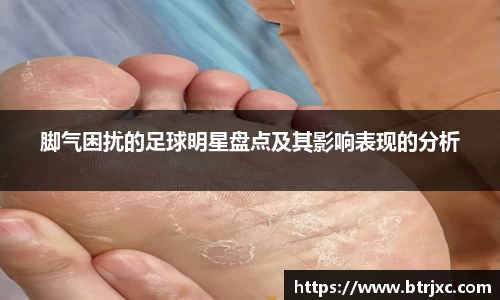 脚气困扰的足球明星盘点及其影响表现的分析